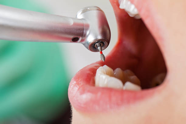 Best Walk-In Emergency Dentist in North Fair Oaks, CA